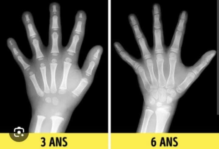 🖐️✍️ Pourquoi il est normal qu’un enfant de moins de 6 ans ait du mal à écrire ?

Leurs os, notamment ceux des mains, sont encore en formation et en croissance. Il est donc tout à fait normal qu’il...